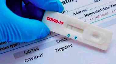 Según el ministerio de Ciencia y Tecnología, los test para coronavirus que trajeron de China son defectuosos
