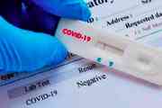 Según el ministerio de Ciencia y Tecnología, los test para coronavirus que trajeron de China son defectuosos