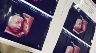 En Formosa entregaban la misma imagen ecográfica a las embarazadas