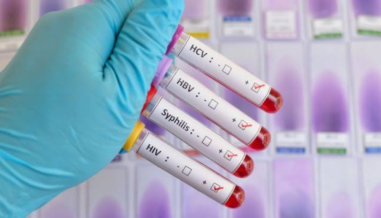 Las infecciones de transmisión sexual encabezan los contagios detectados en Junín