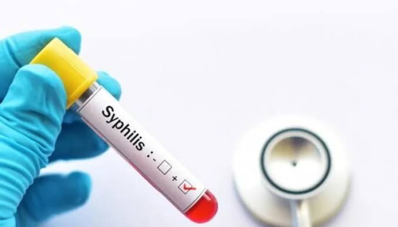 Aumentaron los casos de sífilis en el país