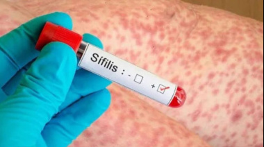 Alarma en Bahía Blanca: los casos de sífilis crecieron un 677% en cinco años y marcan un récord histórico