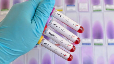 Las infecciones de transmisión sexual encabezan los contagios detectados en Junín