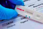 Según el ministerio de Ciencia y Tecnología, los test para coronavirus que trajeron de China son defectuosos  